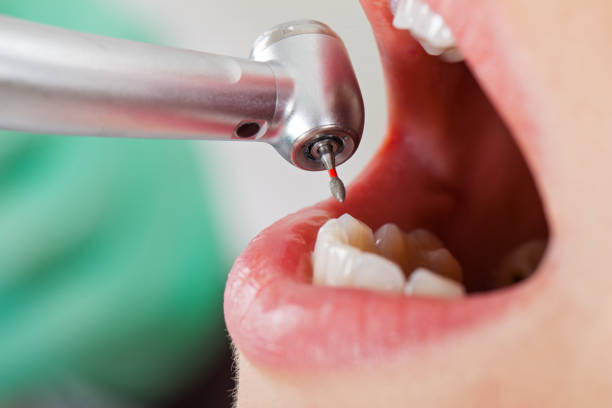 Best Tooth Infection Emergency Dentist  in Austin, MN